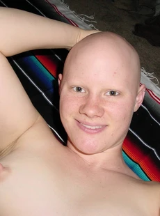 IShotMyself bald beauty